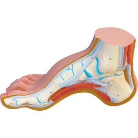 FABRICATION ENTERPRISES 3B® Anatomical Model - Hollow Foot (Pes Cavus) 1060635